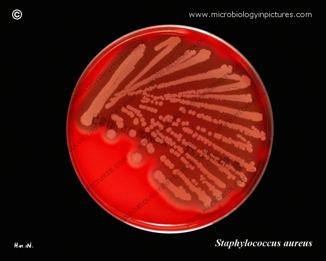 staph aureus on agar with sheep blood